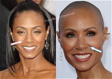 Jada Pinkett Smith's Nose Job: Before and After Photos