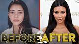 Kim K's Transformation: Before and After Bbl